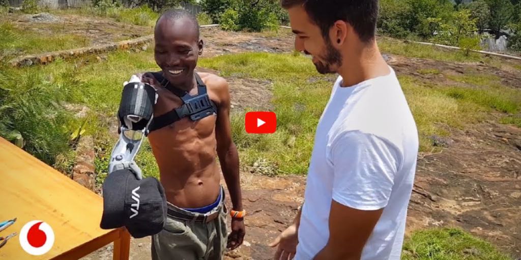 Prótesis impresas en 3D para personas de países sin recursos